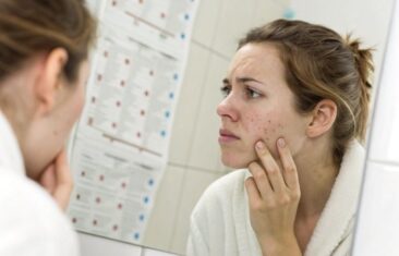 Акне у взрослых: гормональные причины и медицинские аспекты